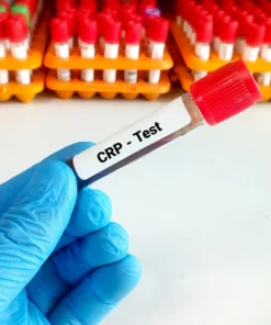 CRP Blood Test UK | C-Reactive Protein & Inflammation Test