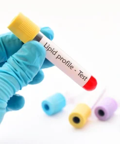 Lipid Profile Blood Test UK | Cholesterol, HDL, LDL & Triglycerides